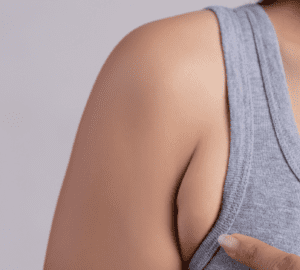 How to Get Rid of Armpit Fat Quickly