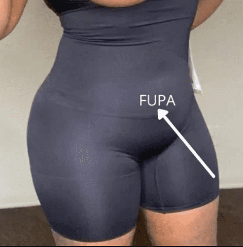 What Does a FUPA Look Like