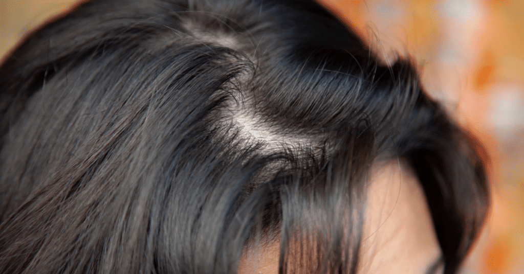 How to Get Rid of Greasy Hair Without Washing It